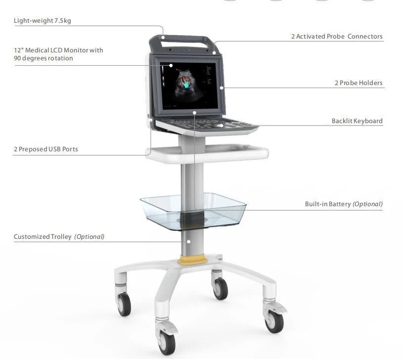 High Quality Pediatric Cardiovascular Wireless Scanner Handheld Vet Portable Ultrasound Machine MCU-CD001