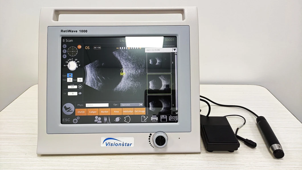 Retiwave-1000 China Manufacturer Best Price Eye Exam Ophthalmology Diagnostic Equipment a B Scanner Ophthalmic Ab Scan Ultrasound Machine