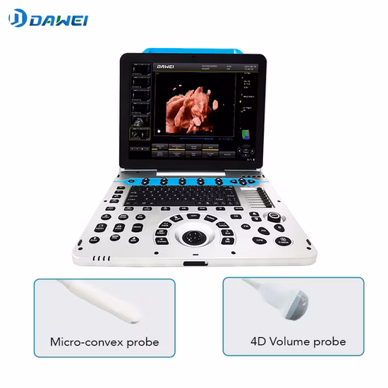Chison Ebit50 4D 5D Doppler color portátil Sistema de imágenes diagnósticas digitales Ultrasonido humano Ginecología, máquina de eco cardiovascular